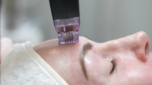 dry eye therapy